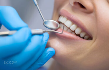 LASER DENTISTRY